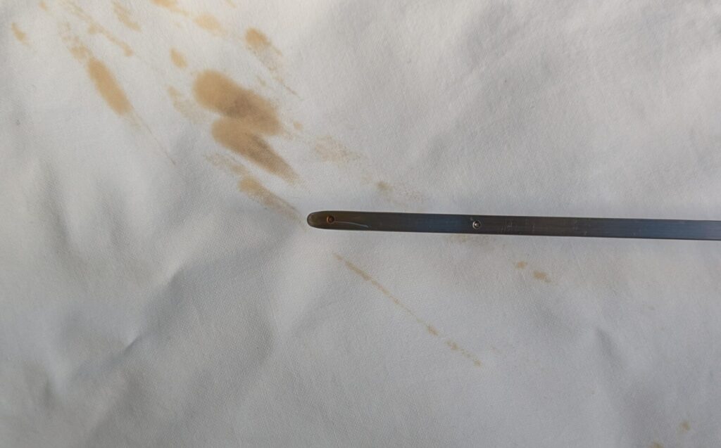 オイル診断写真